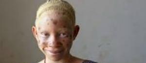 Suicídio e rapto frustrado na Zambézia Suicídio e rapto frustrado na Zambézia